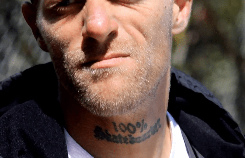 Skateboarding vs hemeroidy